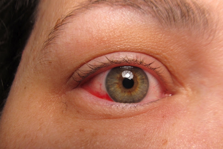 A szem leggyakoribb megbetegedései